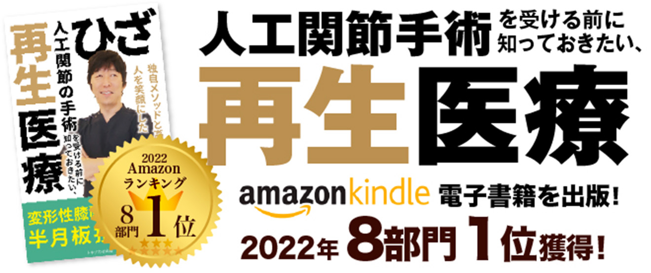 amazon書籍 人口関節手術を受ける前に知っておきたい、再生医療