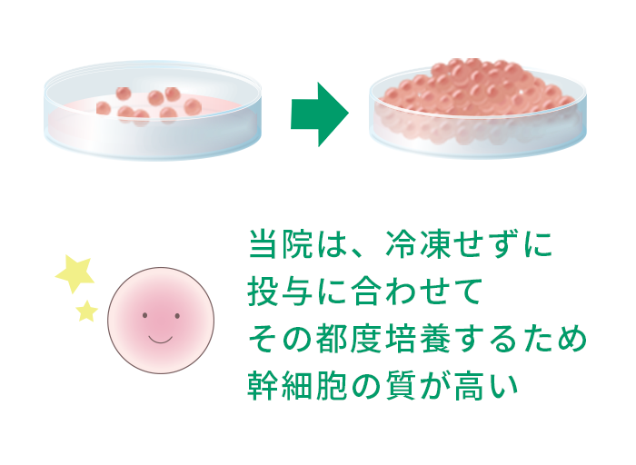 当院は、冷凍せずに投与に合わせてその都度培養するため幹細胞の質が高い