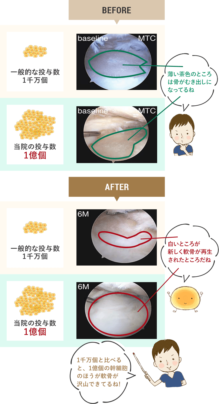 図:一般的な投与数と当院の投与数の違い