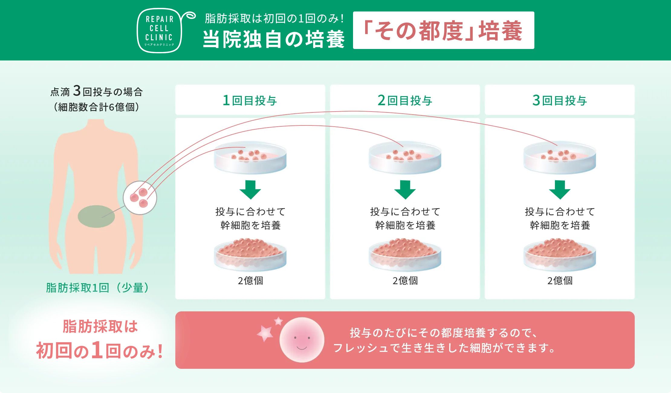 脂肪採取は初回の1回のみ!当院独自の培養「その都度」培養