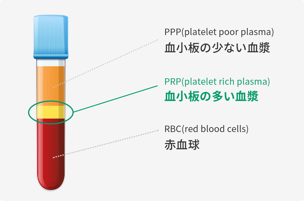 PRP（多血小板血漿）療法とは