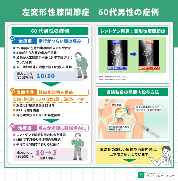 症例画像