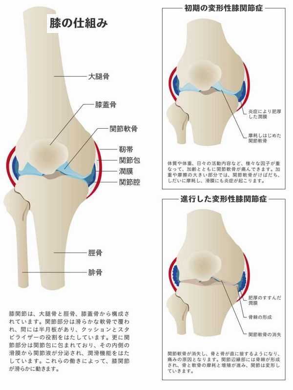 膝の仕組みと痛みの原因