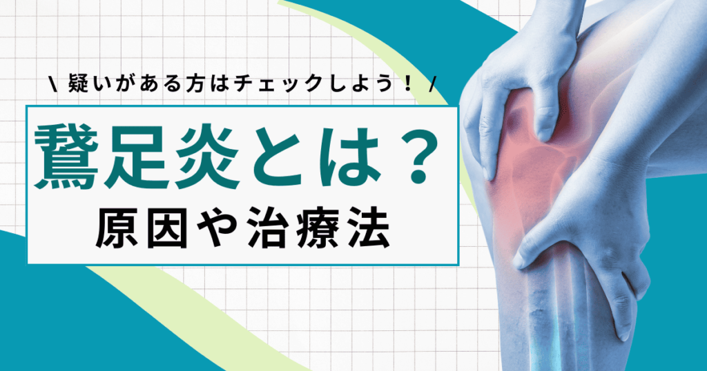 鵞足炎（がそくえん）とは？膝の痛みの原因や治療法、治るまでの期間を解説