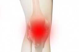 膝関節の痛み