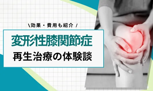 prp療法 膝 体験談