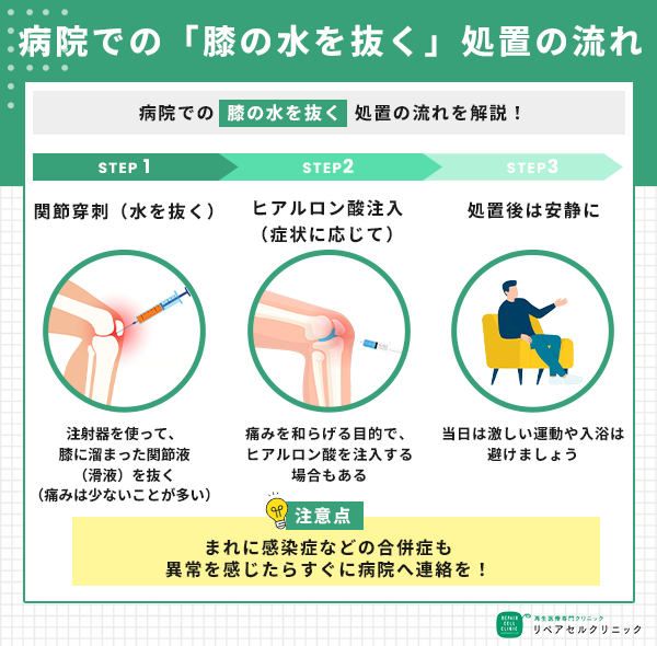 病院での「膝の水を抜く」処置の流れ