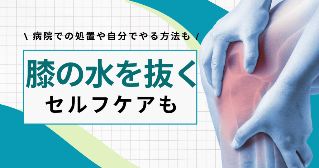 膝の水を抜く方法とは？病院での処置や自分でできるストレッチも紹介【医師監修】