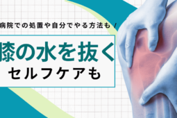 膝の水を抜く方法とは？病院での処置や自分でできるストレッチも紹介【医師監修】