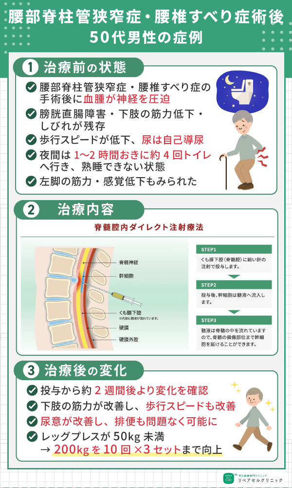 腰椎すべり症の症例