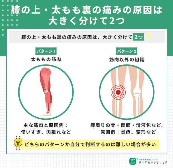 膝の上・太もも裏の痛みの原因は大きく分けて2つ