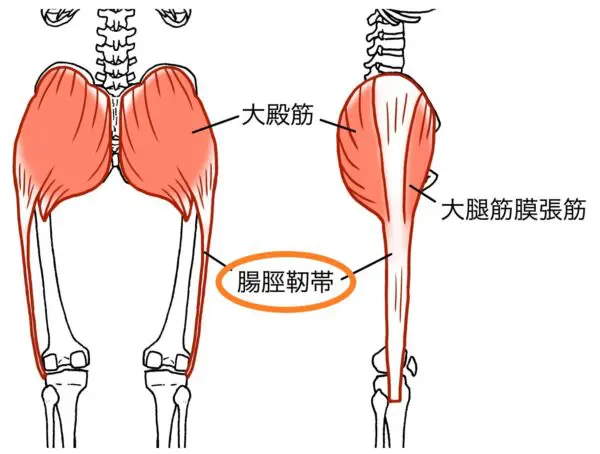 iliotibial tendonitis e1667376791463.jpg 1