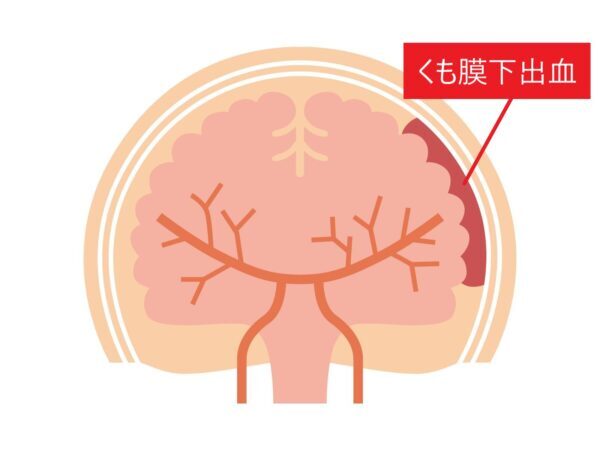 避妊は月経に影響しますか?