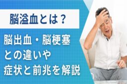 脳溢血とは？脳出血・脳梗塞との違いや症状・前兆を医師が詳しく解説