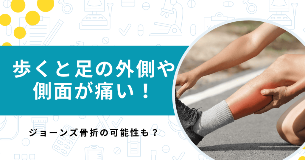 歩くと足の外側・側面が痛い！考えられる疾患ジョーンズ骨折とは？【医師解説】