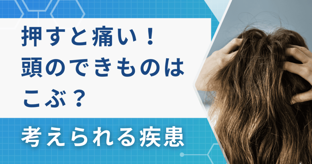 押すと痛い！頭のできもの（こぶ）はなに？考えられる疾患や受診の目安を解説