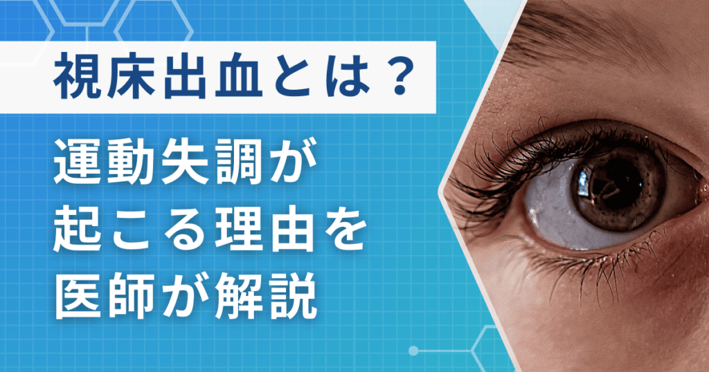 視床出血による運動失調が起こる理由は？種類と特徴を医師が解説