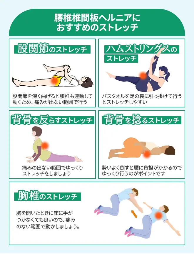 腰椎椎間板ヘルニアにおすすめのストレッチ