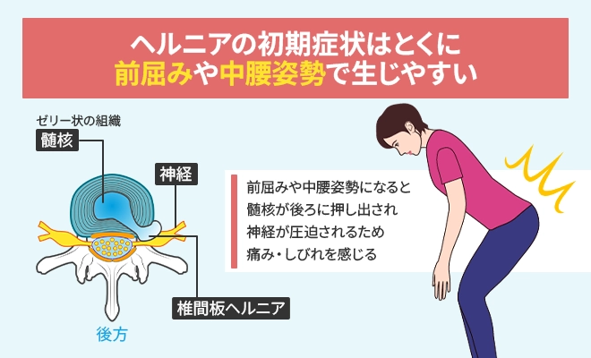 ヘルニアの初期症状はとくに前屈みや中腰姿勢で生じやすい