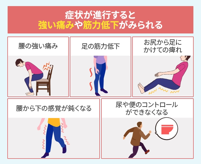 症状が進行すると強い痛みや筋力低下がみられる