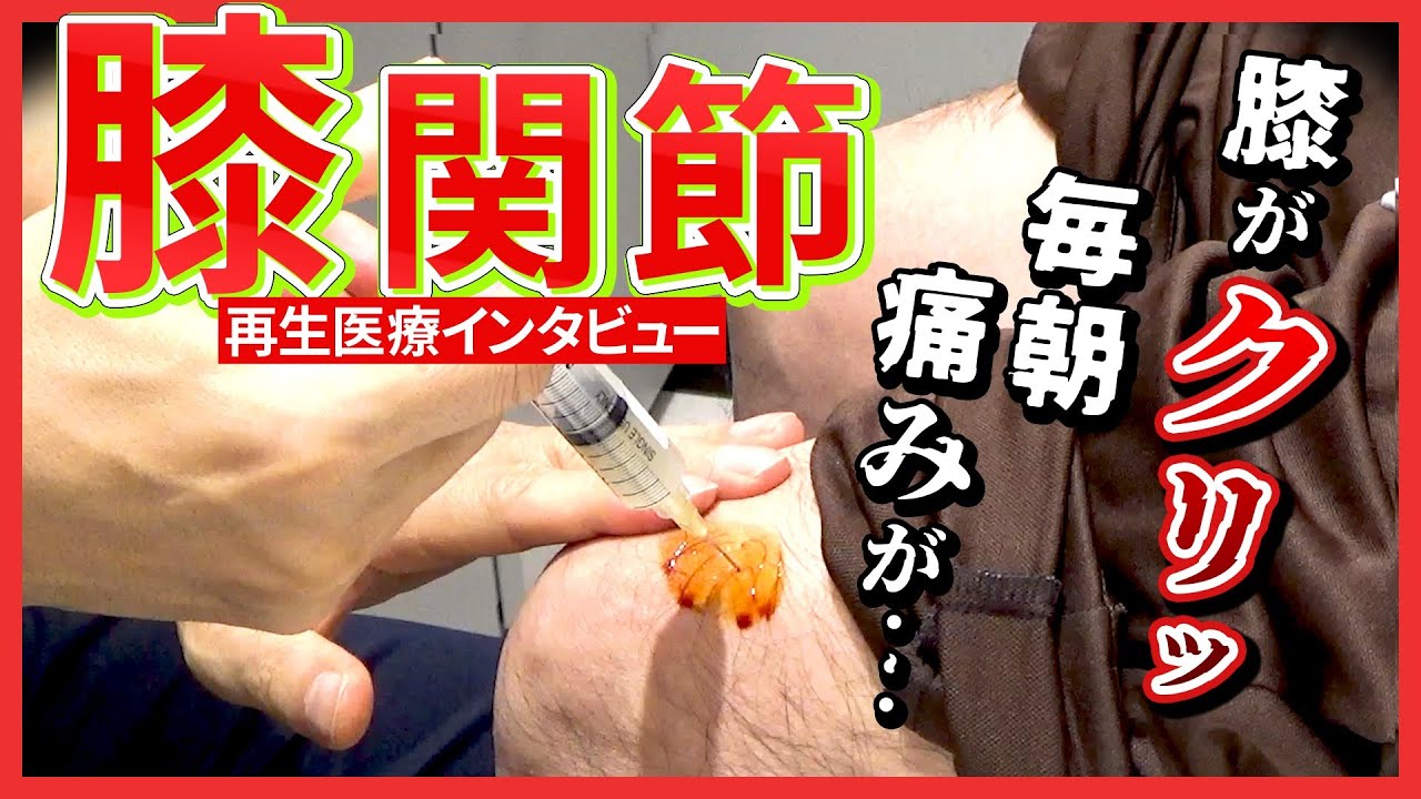 半月板損傷・変形性膝関節症】手術の宣告も再生医療（幹細胞治療）を
