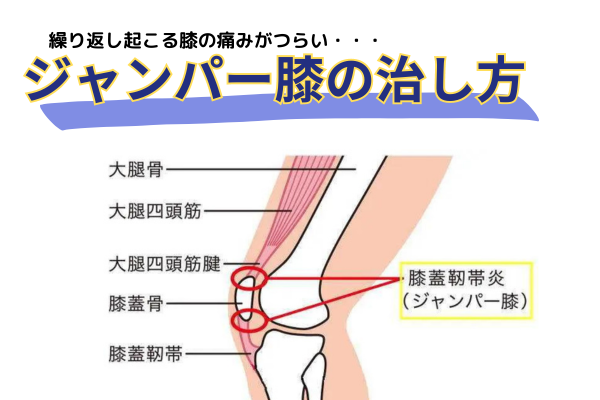 ジャンパー膝（膝蓋腱炎）