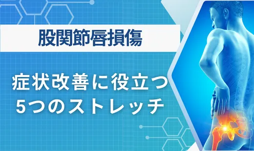 股関節唇損傷 ストレッチ