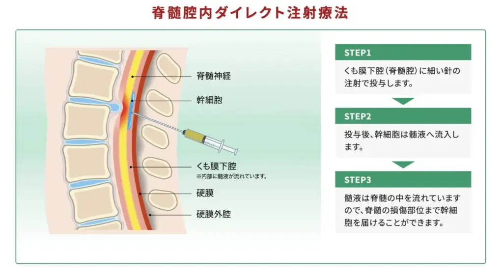 頚椎症性脊髄症の手術成功率は？手術の効果や注意点を解説