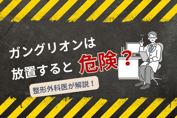 ガングリオンは放置すると危険？ 自然に消える確率や対処法について整形外科医が解説！