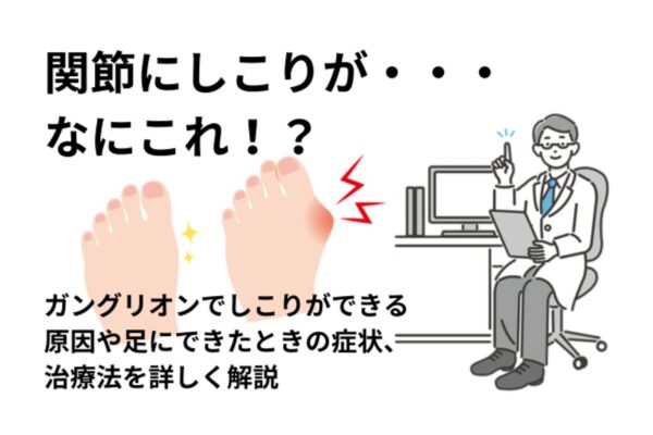 ガングリオン足の原因と症状、最適な治療法を解説