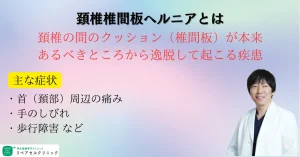 頚椎椎間板ヘルニアとは