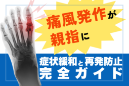 痛風発作が足の親ゆびに！症状の緩和と再発予防のための完全ガイド