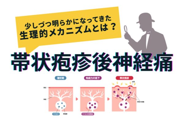 帯状疱疹後神経痛の謎を解く！その生理学的メカニズムとは？