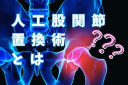 artificial hip joint