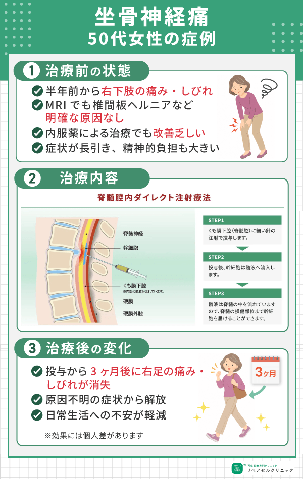 座骨神経痛症例画像
