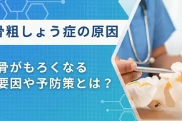 骨粗しょう症 原因