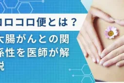 コロコロ便 大腸がん