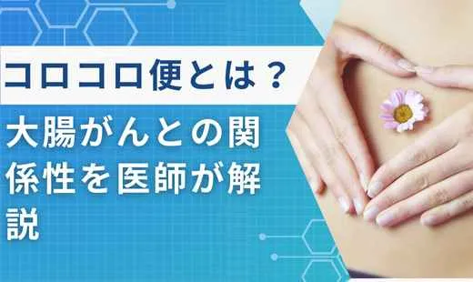 コロコロ便 大腸がん