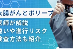 大腸がん ポリープ違い