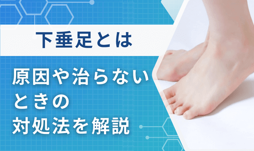 下垂足とは