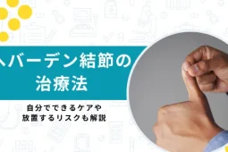 ヘバーデン結節 治療