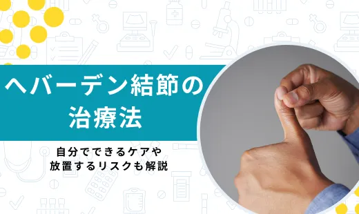 ヘバーデン結節 治療
