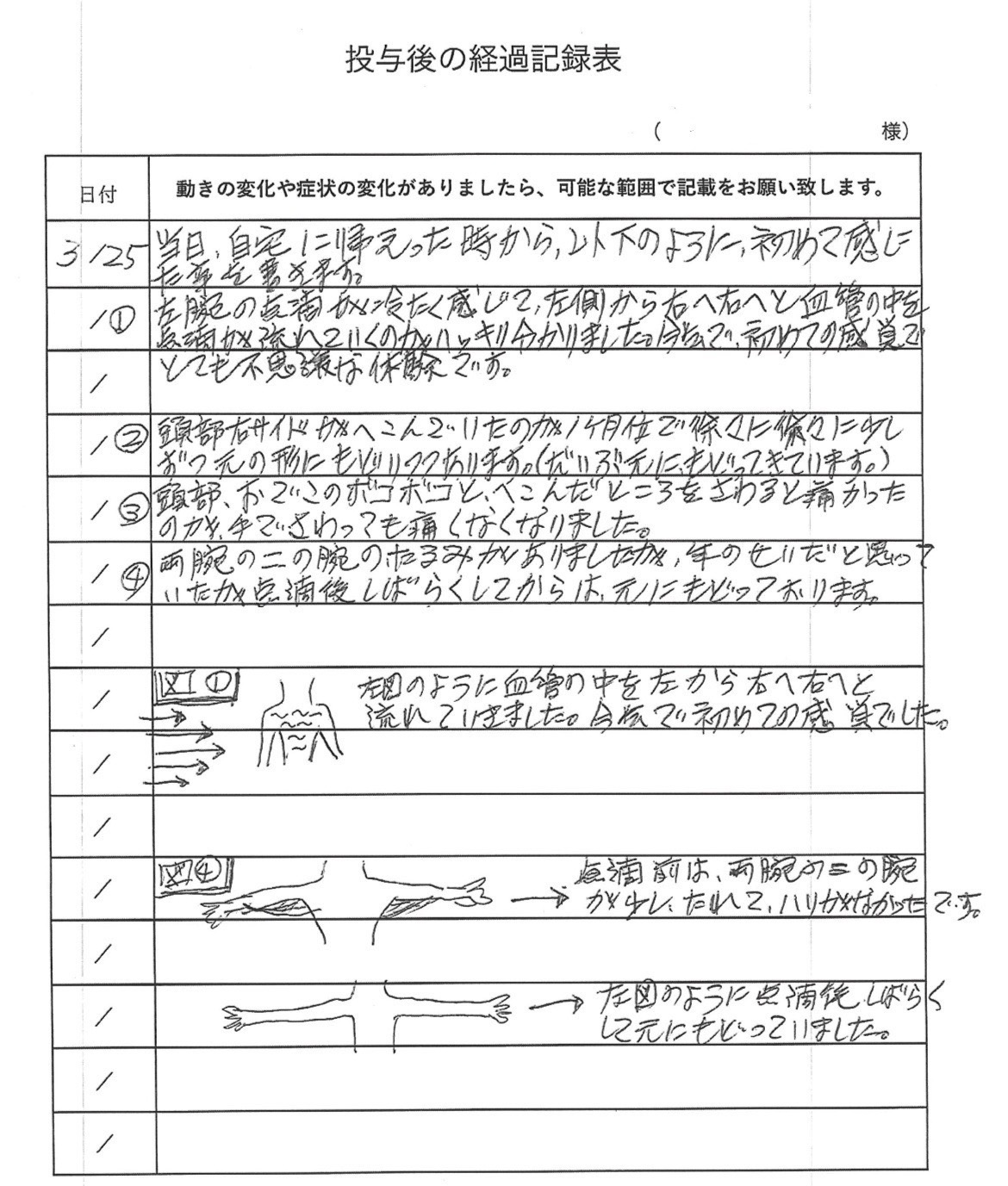 くも膜下出血　幹細胞治療