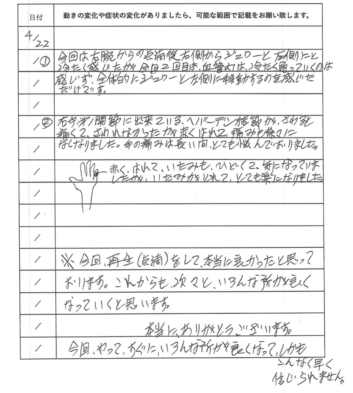 くも膜下出血　幹細胞治療