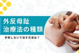 外反母趾 治療