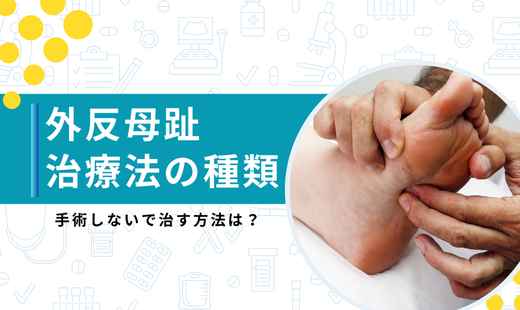 外反母趾 治療