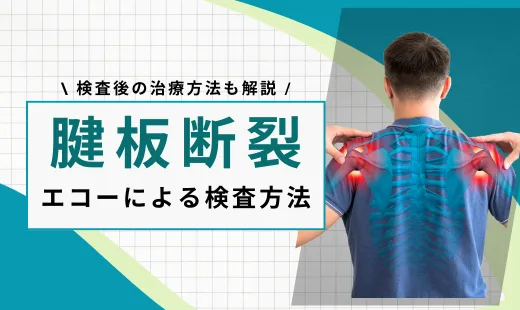 腱板断裂 エコー