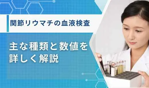 関節リウマチ 血液検査