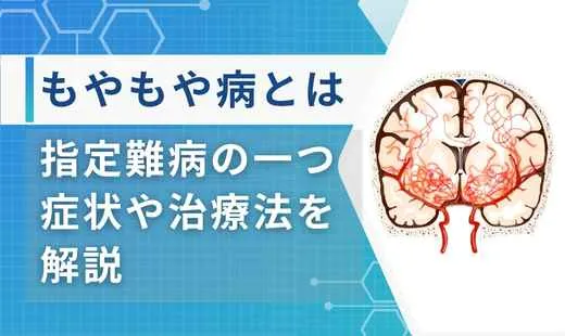 もやもや病とは