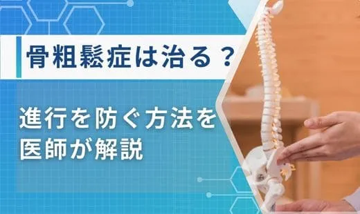 骨粗鬆症 治るのか
